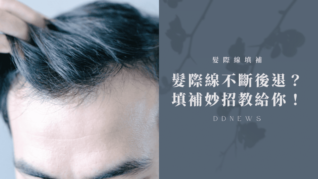 髮際線不斷往後退？這個填補妙招你一定要試試！