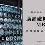 時常忽略頭痛警訊？健檢多做一樣【腦部磁振造影MRI】健康不煩「腦」！