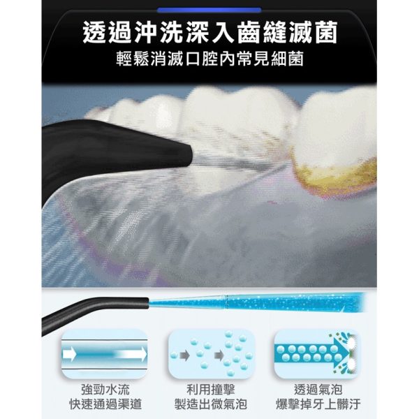 未來實驗室 OCare Clean 藍氧洗牙機 沖牙機：圖片 11