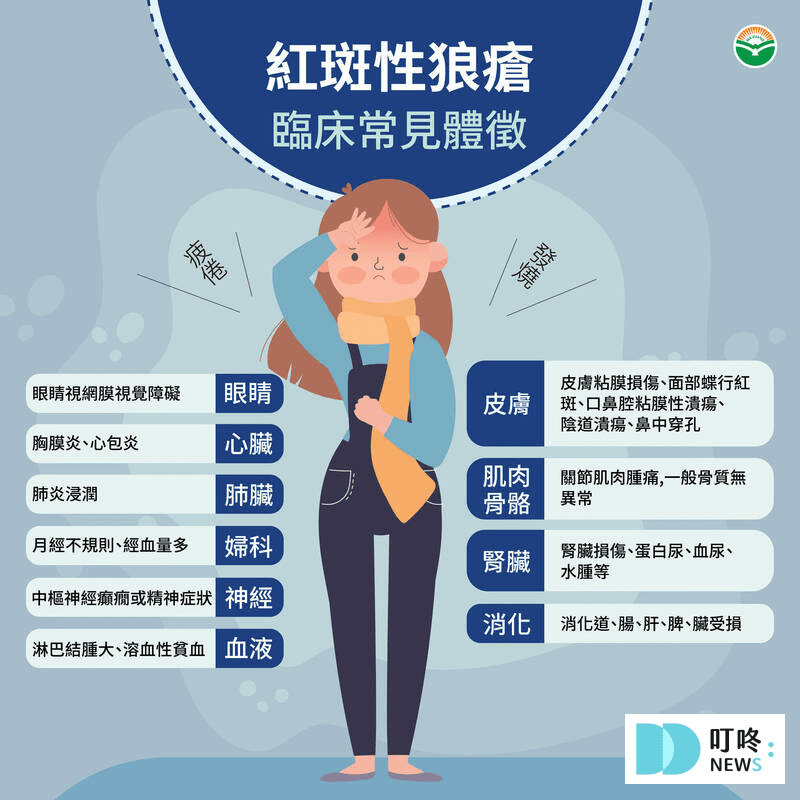 紅斑性狼瘡症狀