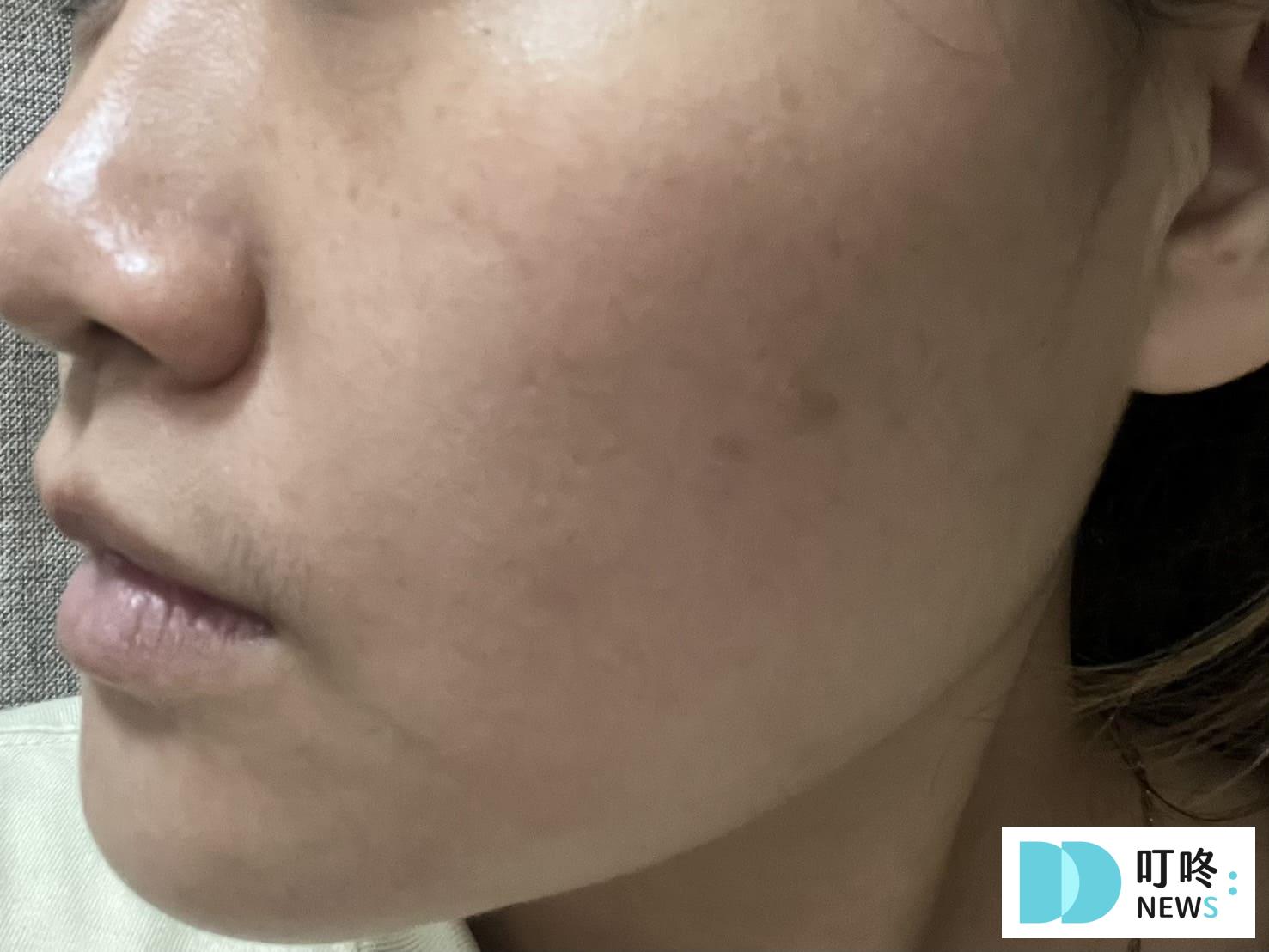INNISFREE A醇淨膚超修護安瓶|真實開箱使用方法與評價,ptt、dcard好評推薦居家修護好氣色 叮咚News|分享新奇與樂趣