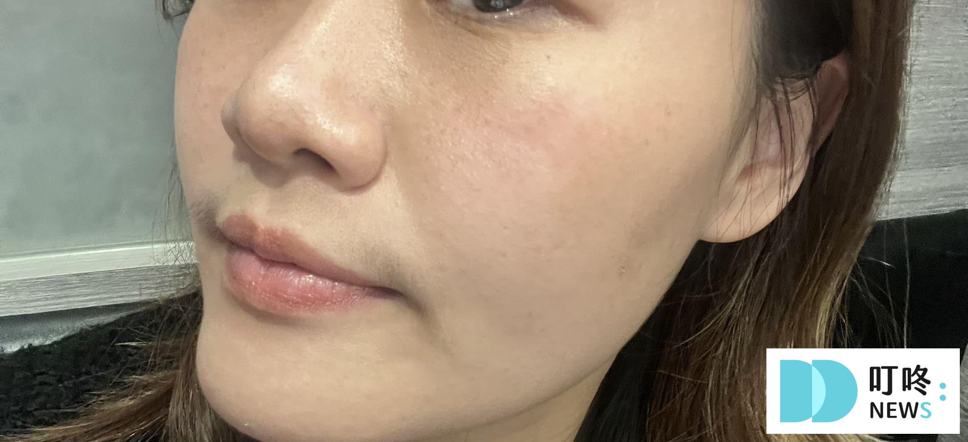 未來美面膜｜開箱心得評價-使用後